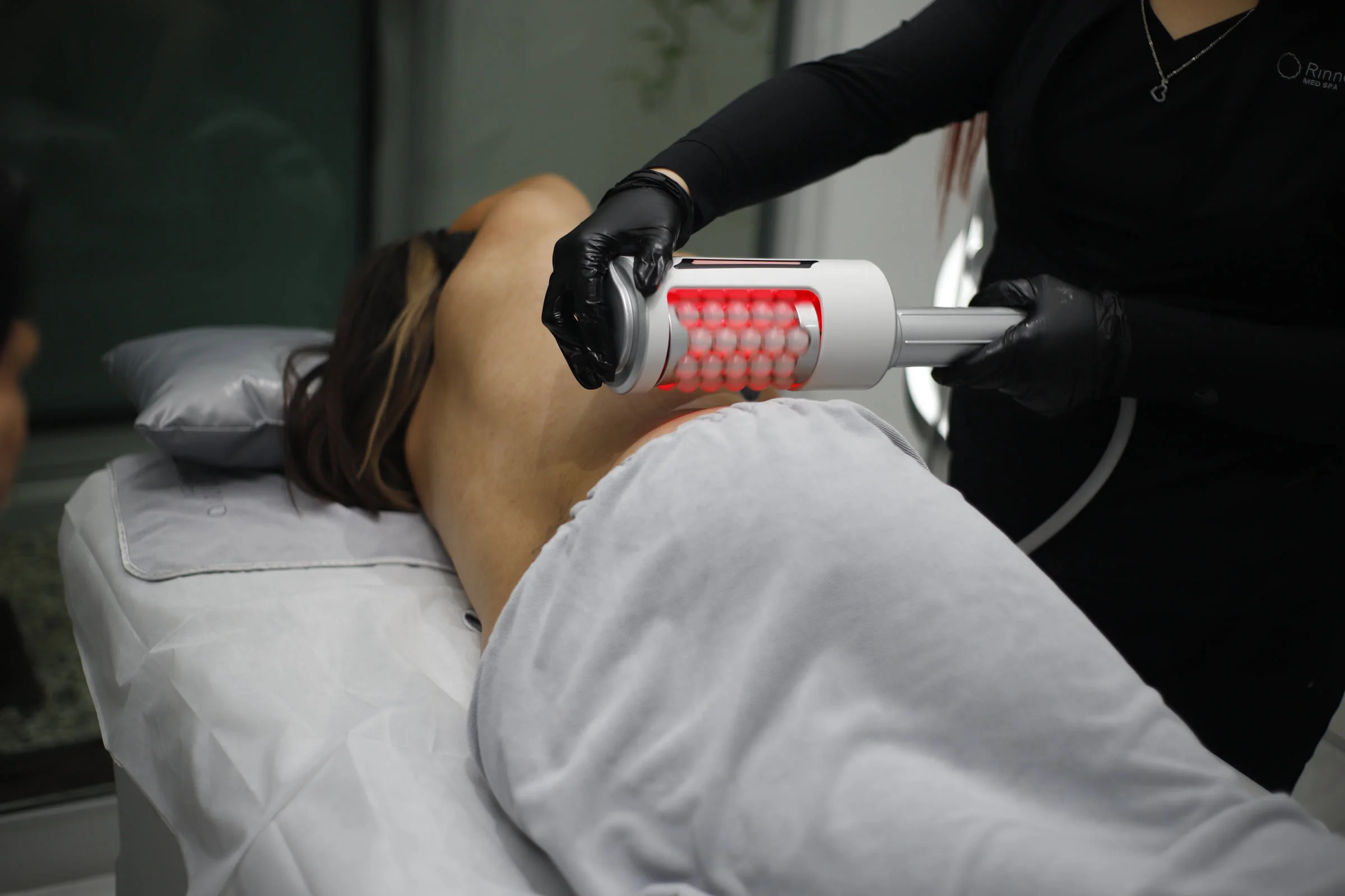 Endosphères Corporal realizado en Rinnovo Med Spa, Reynosa