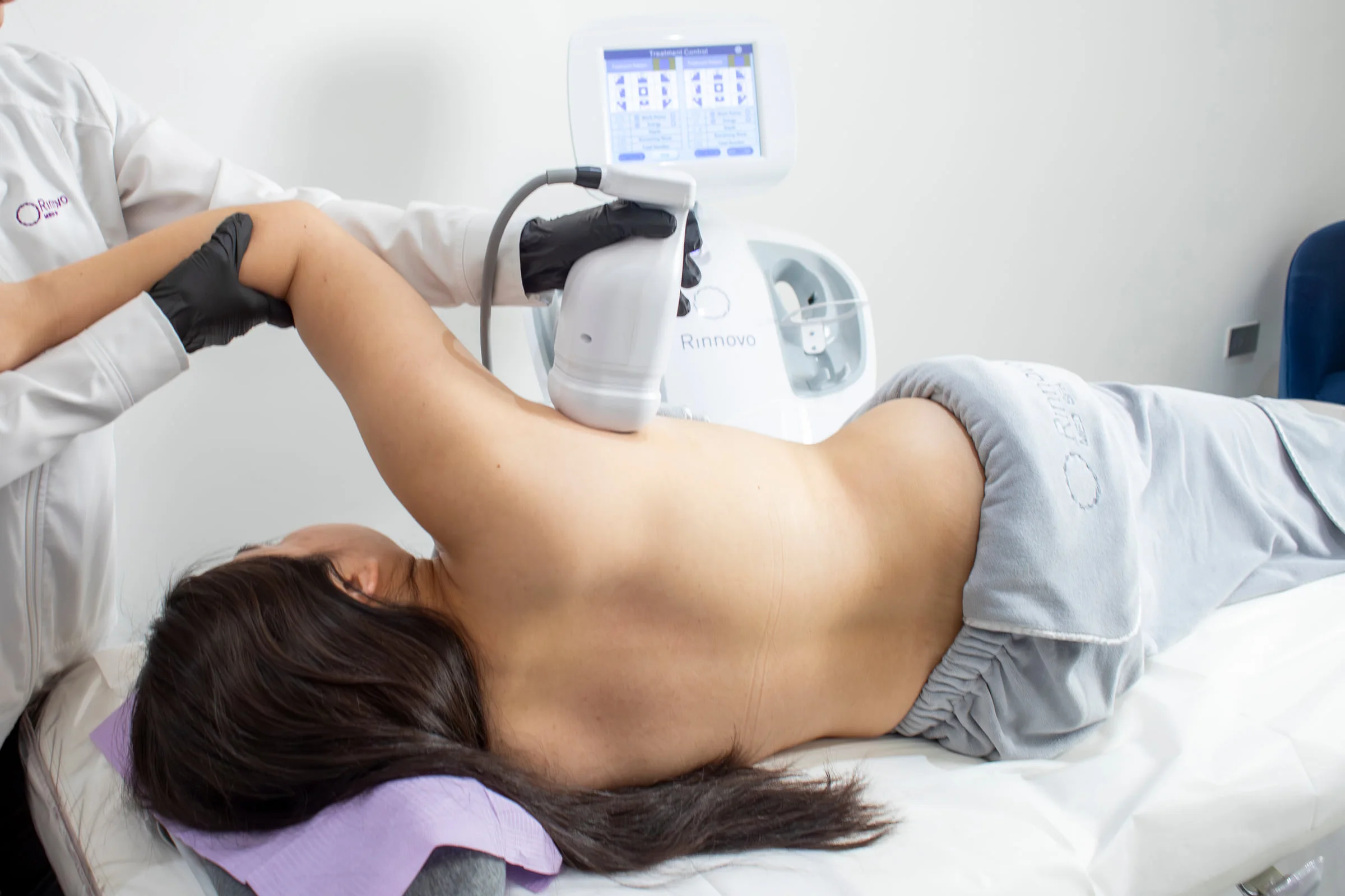 Liposonix realizado en Rinnovo Med Spa, Reynosa